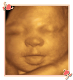 Charlotte 3D Ultrasound Image1