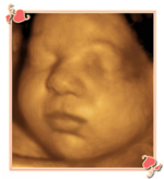 Charlotte 4D Ultrasound Image2
