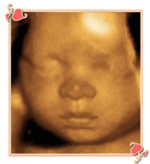 Charlotte 3D 4D Ultrasounds Image2