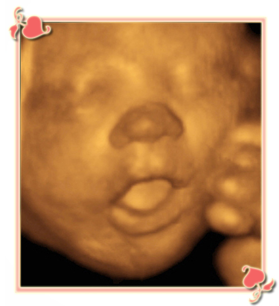 Charlotte 3D/4D Ultrasounds Image2