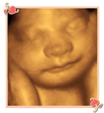 Charlotte 3D 4D Ultrasounds Image2