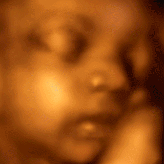 Charlotte 3D/4D Ultrasound picture and photographs