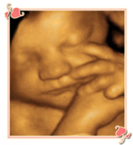 Charlotte 3D Ultrasound Image2