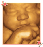 Charlotte 4D Ultrasound Image1