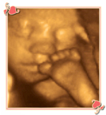 Charlotte 3D 4D Ultrasound Image2