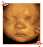 Charlotte 3D/4D Ultrasound Image1