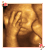 Charlotte 3D/4D Ultrasound Image3